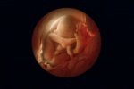 36 Weeks