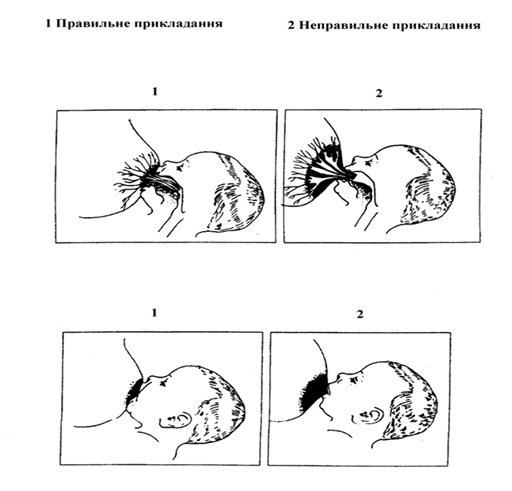 prykladannya grudey