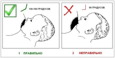zaxoplennya