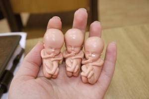 nok-az-abortusz-utan.jpg